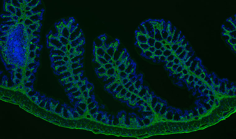 Microbiome Research: Graham