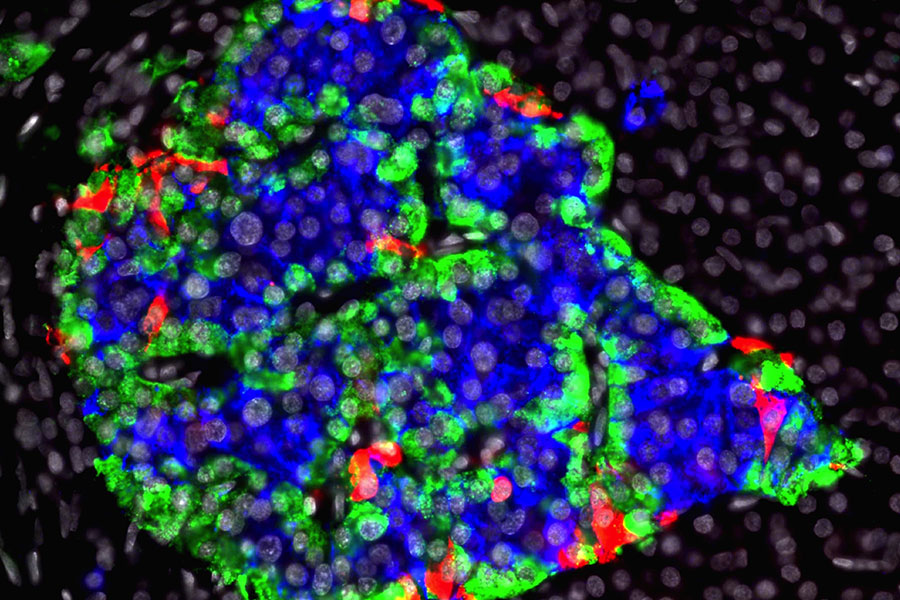 Beta cells of the pancreas