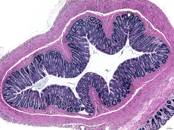 Micrograph images of colon tissue in a mouse model of colitis.